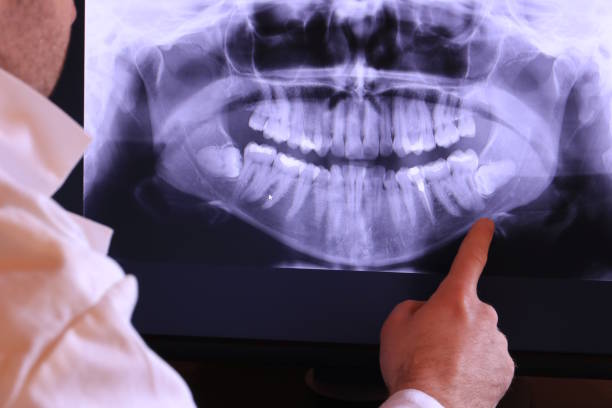 Best Pediatric Emergency Dentist in Ivanhoe, CA