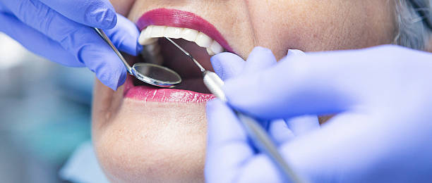Best Weekend Emergency Dentist in Ivanhoe, CA